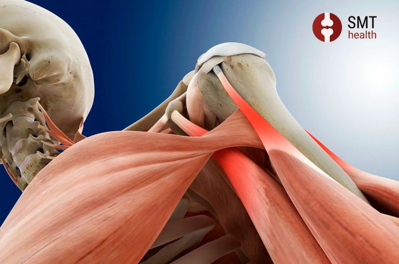 Повреждение вращательной манжеты плеча