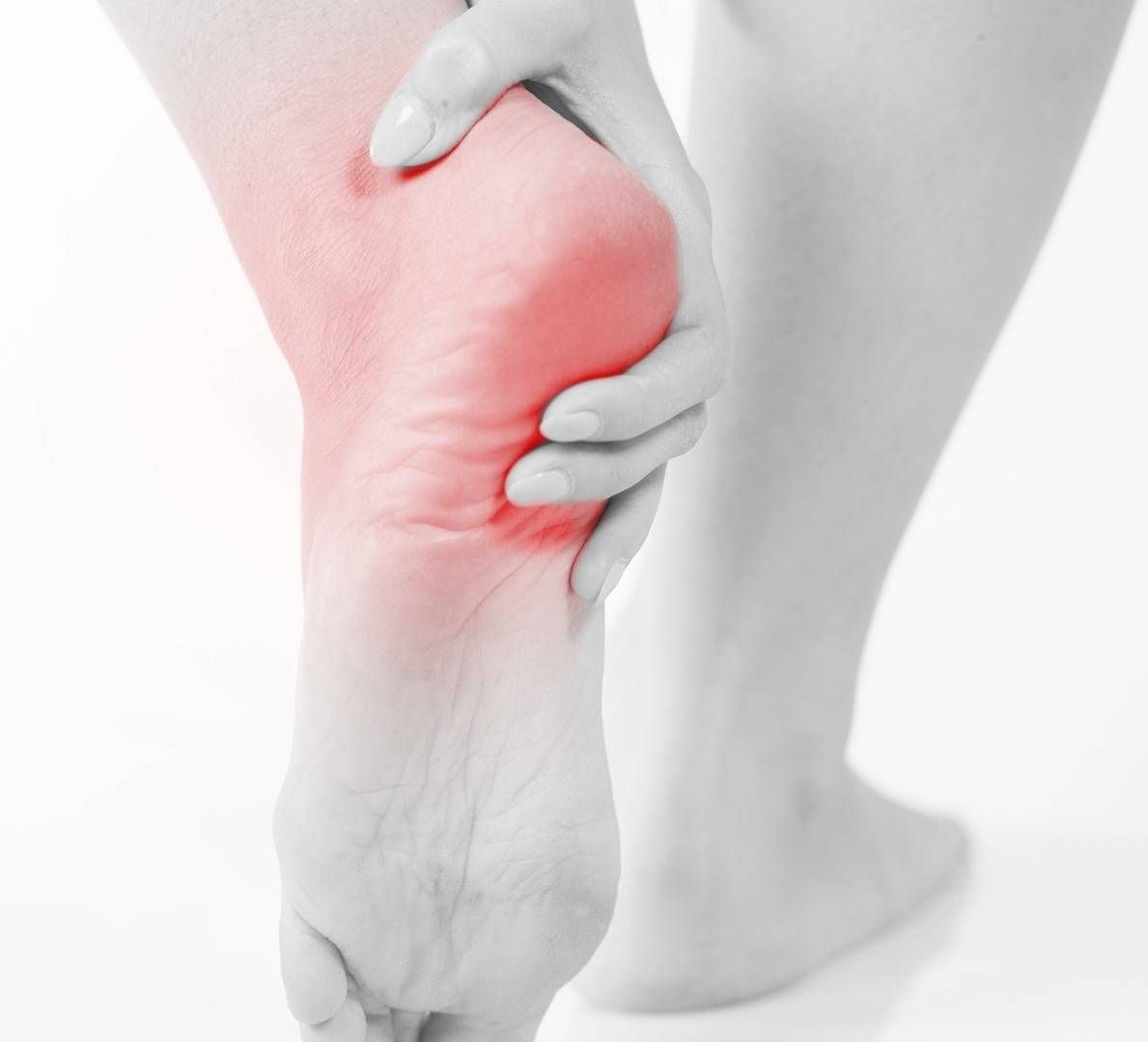 Подошвенный фасциит