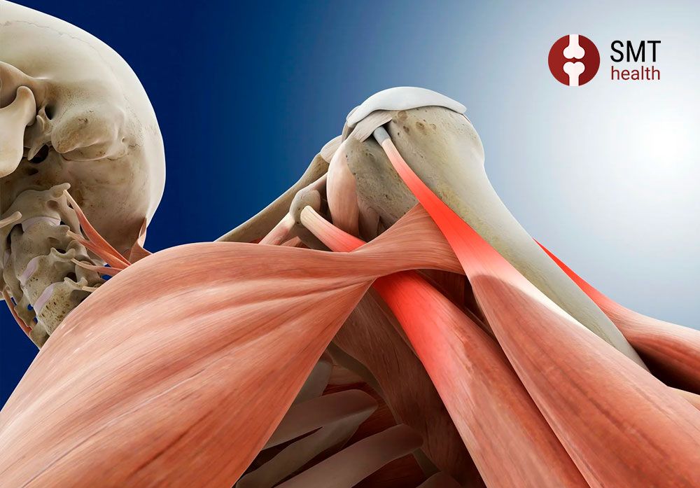 Повреждение вращательной манжеты плеча