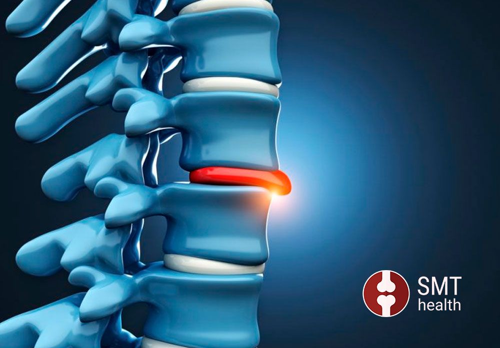Грыжа межпозвоночного диска
